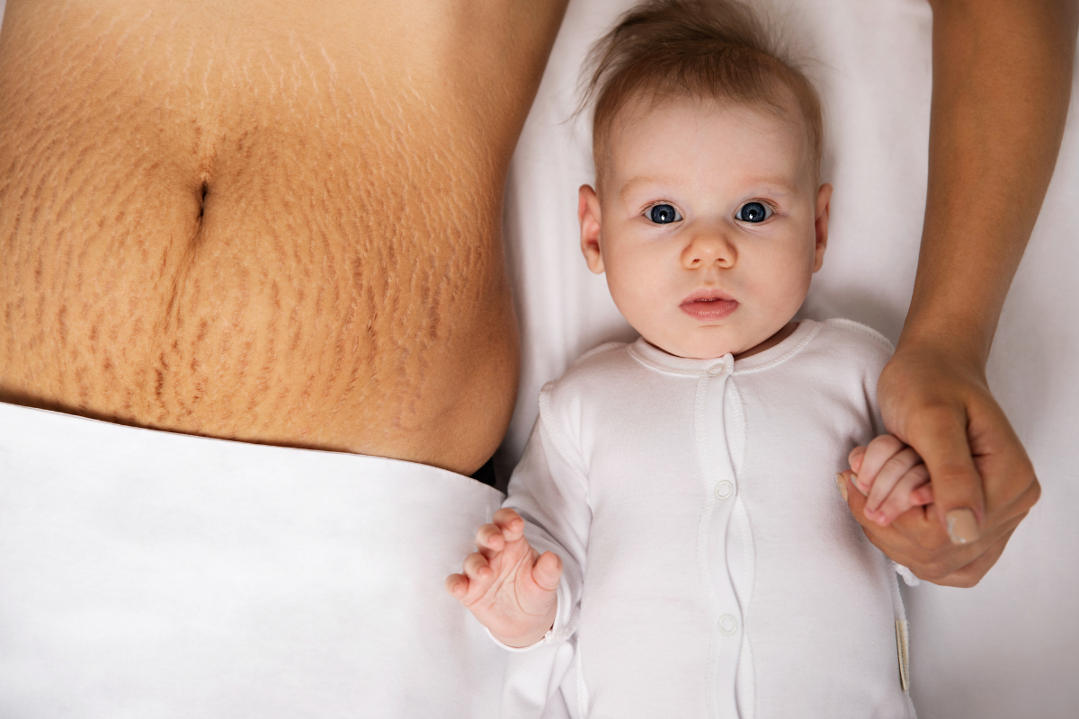 Brzuch po ciąży – jak odzyskać dawną sylwetkę zdrowo, bezpiecznie i szybko?